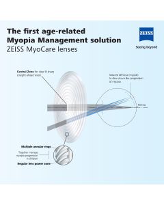 ZEISS MyoCare Lens Design